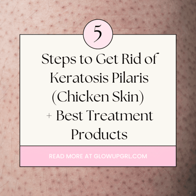 Steps to Get Rid of Keratosis Pilaris (Chicken Skin) + Best Treatment Products