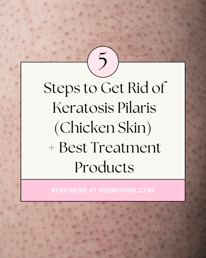Steps to Get Rid of Keratosis Pilaris (Chicken Skin) + Best Treatment Products